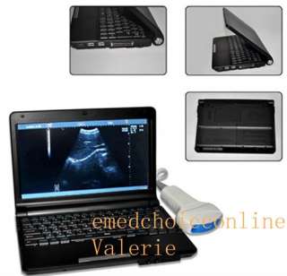   Digital Laptop Ultrasound Scanner/machine +Convex Probe RUS 9000F