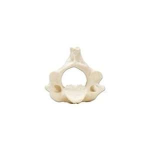  Axis cervical vertebrae model, (no stand) Health 