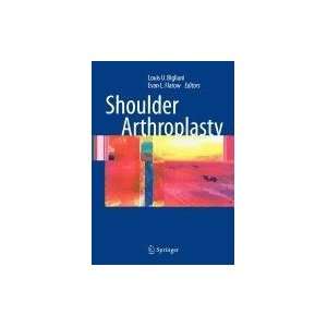  Shoulder Arthroplasty (9780387501598) Books