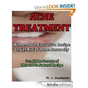 Acne Treatment   Home Made Exclusive Recipe to Get Rid of Acne 